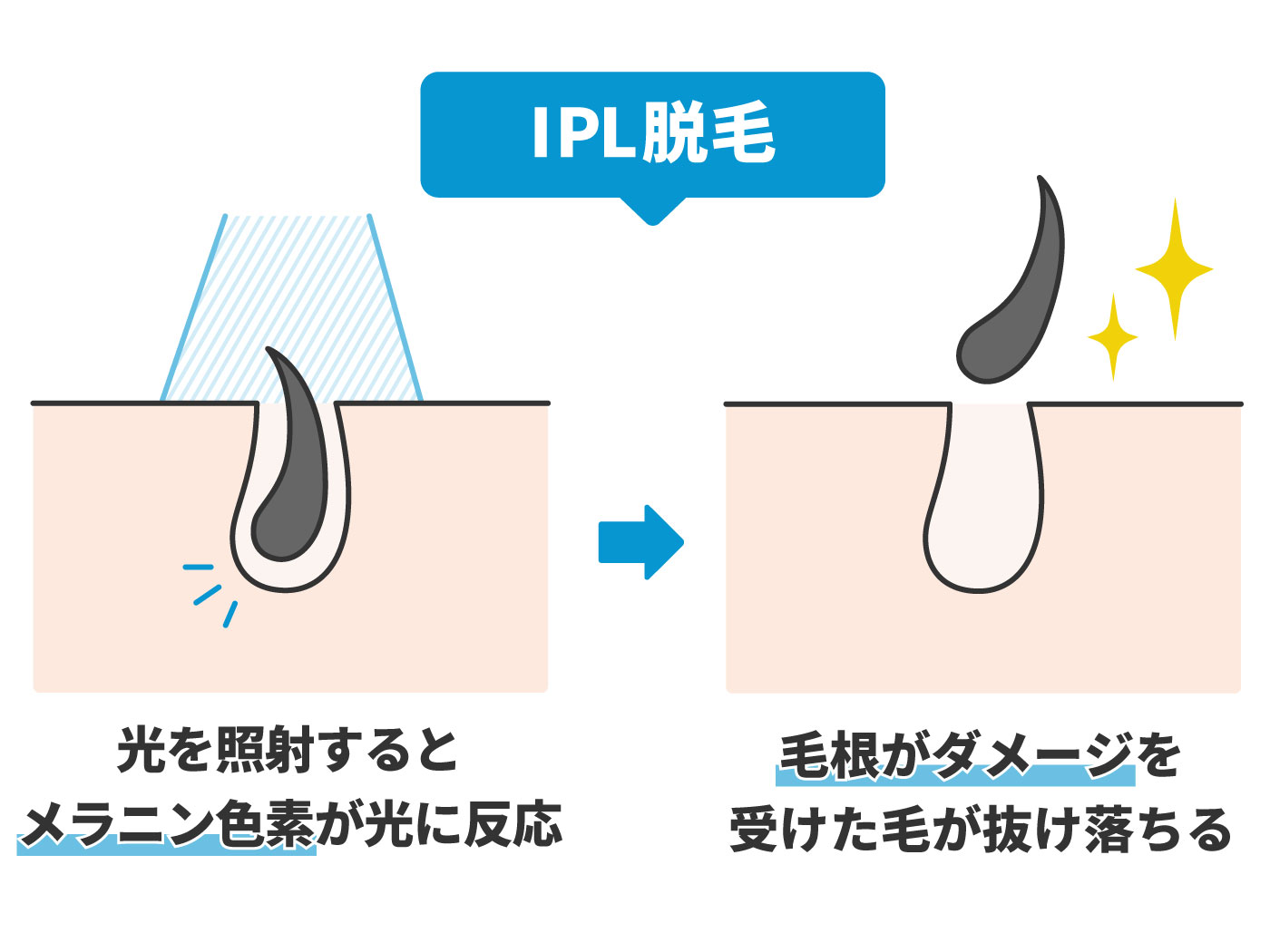 22年 Vio脱毛ができるメンズ脱毛サロンのおすすめ人気ランキング18選 徹底比較 Mybest