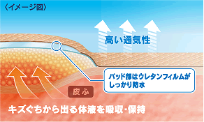 痛みを抑えたいなら、傷口が空気に晒されないモイストヒーリング