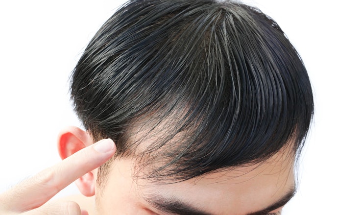 自然に見え、耐久性も高い「人毛」