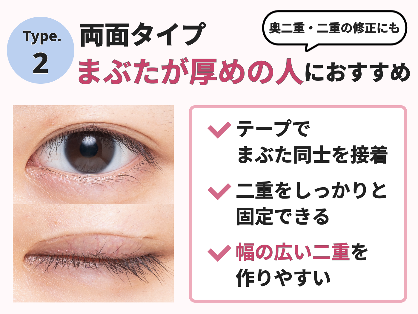 22年 アイテープのおすすめ人気ランキング27選 徹底比較 Mybest