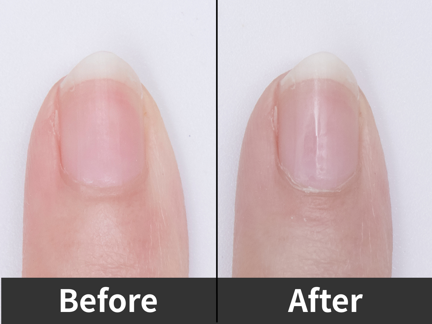 22年 爪磨きのおすすめ人気ランキング18選 徹底比較 Mybest