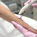 ほくろ除去ができるおすすめのクリニック
