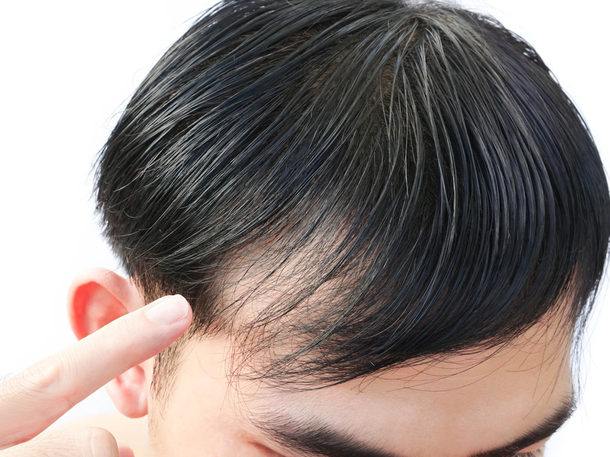 22年 メンズウィッグのおすすめ人気ランキング9選 Mybest 22年 メンズウィッグのおすすめ人気ランキング9選 Mybest