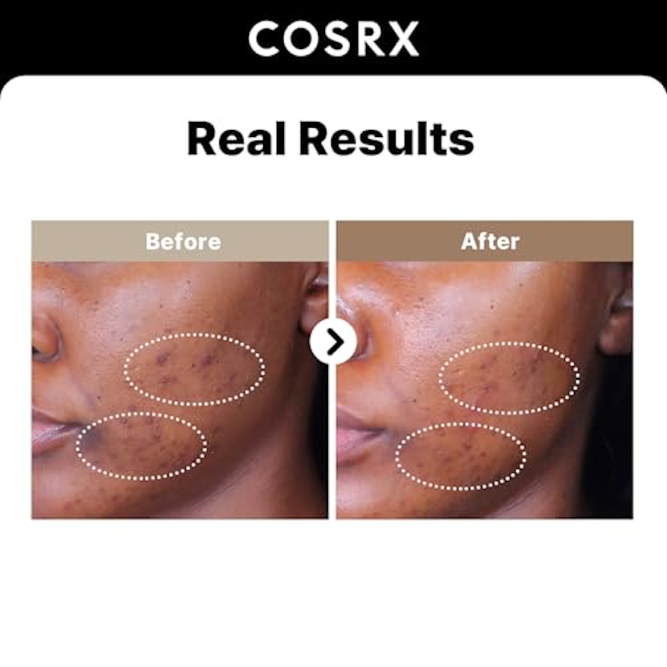 COSRX RX ザ・アルファアルブチン2 ニキビ跡セラム 2枚目