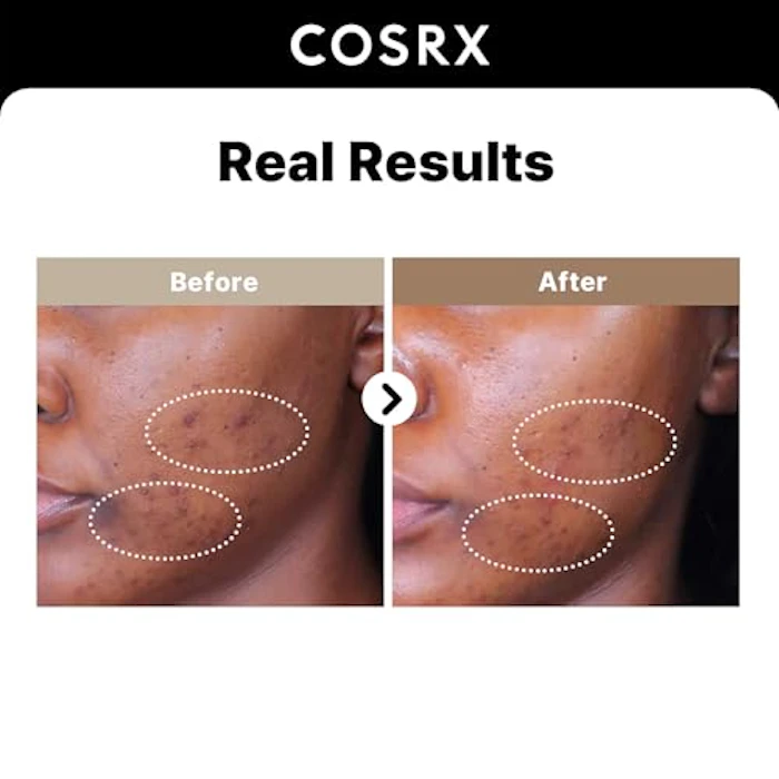 COSRX RX ザ・アルファアルブチン2 ニキビ跡セラム 2枚目