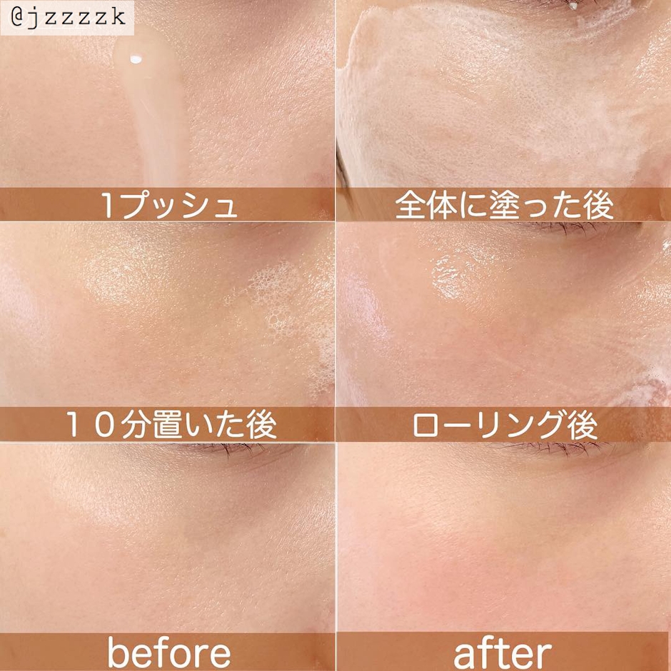 SERENDI BEAUTY BUBBLETOX CLEANSER (バブル トックス クレンザー) 2枚目