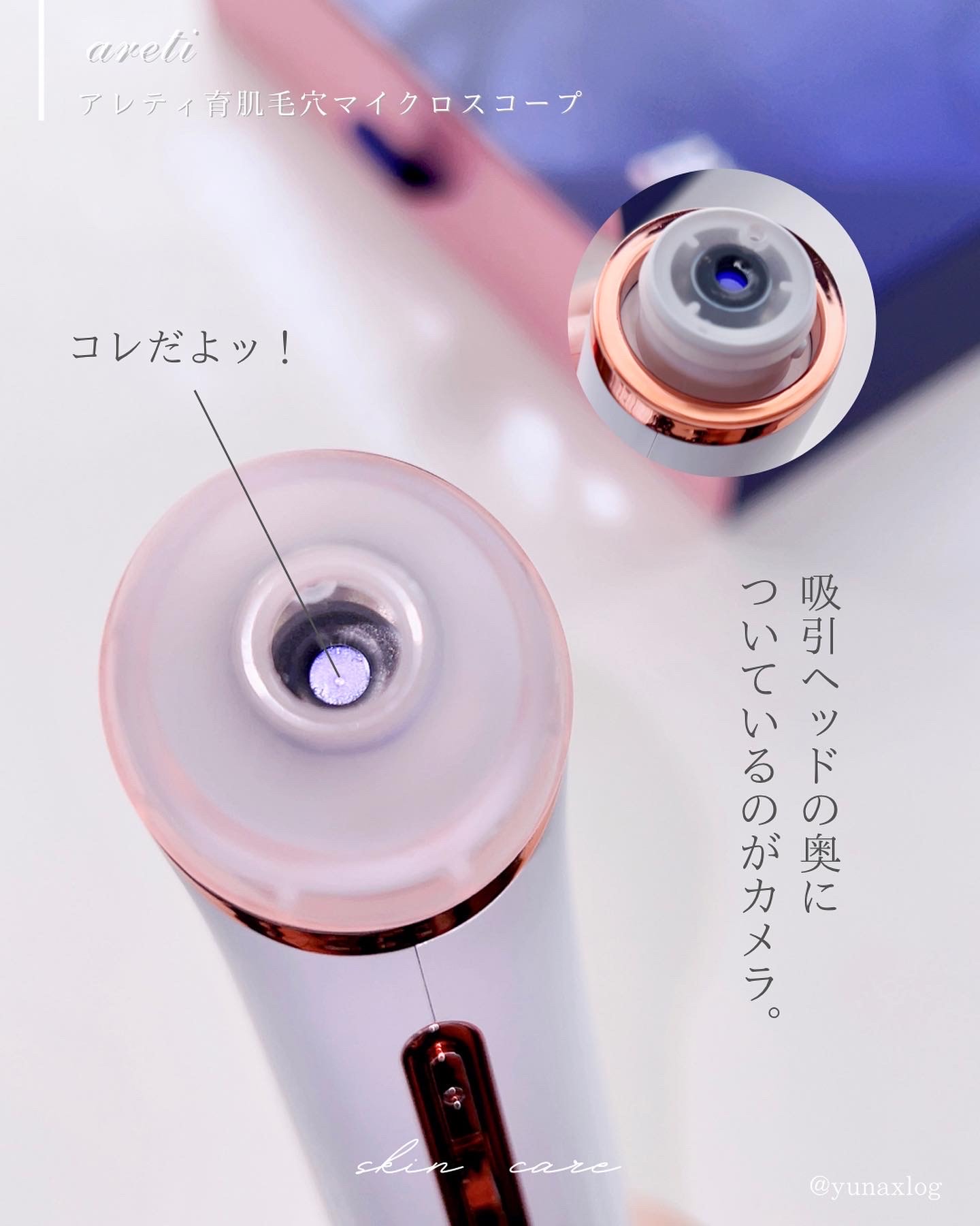 Areti. ポアスコープ 3枚目