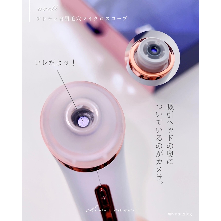 Areti. ポアスコープ 3枚目