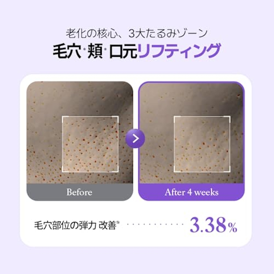 UIQ リジュバイオーム EX リフティングアンプル 10枚目
