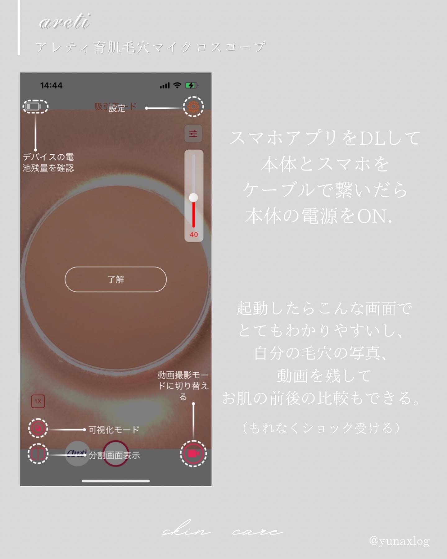 Areti. ポアスコープ 6枚目