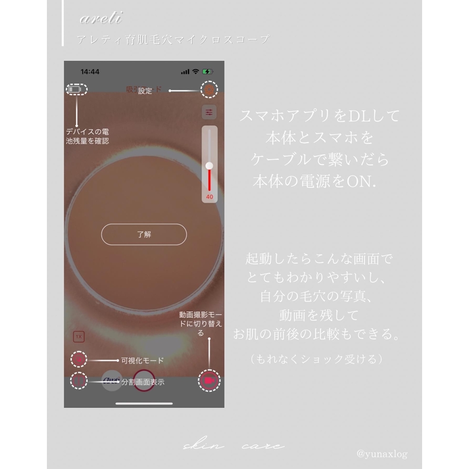 Areti. ポアスコープ 6枚目