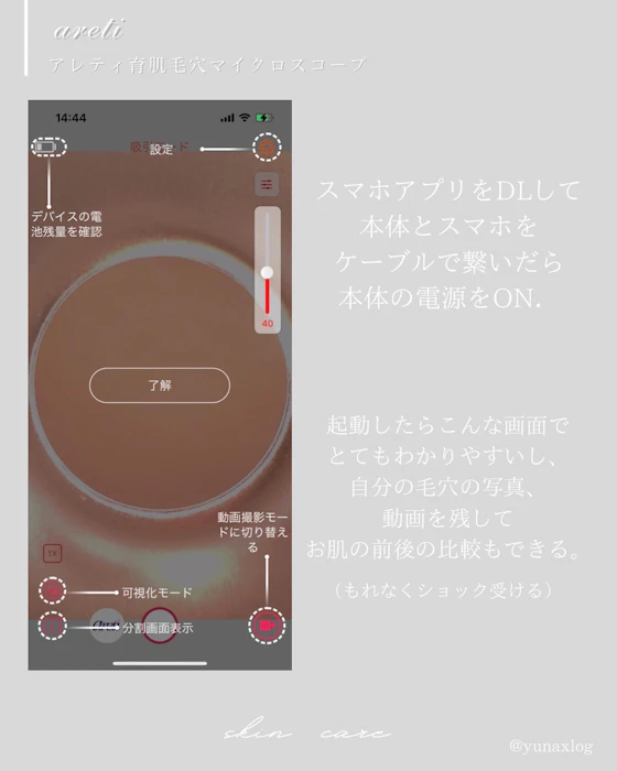 Areti. ポアスコープ 6枚目