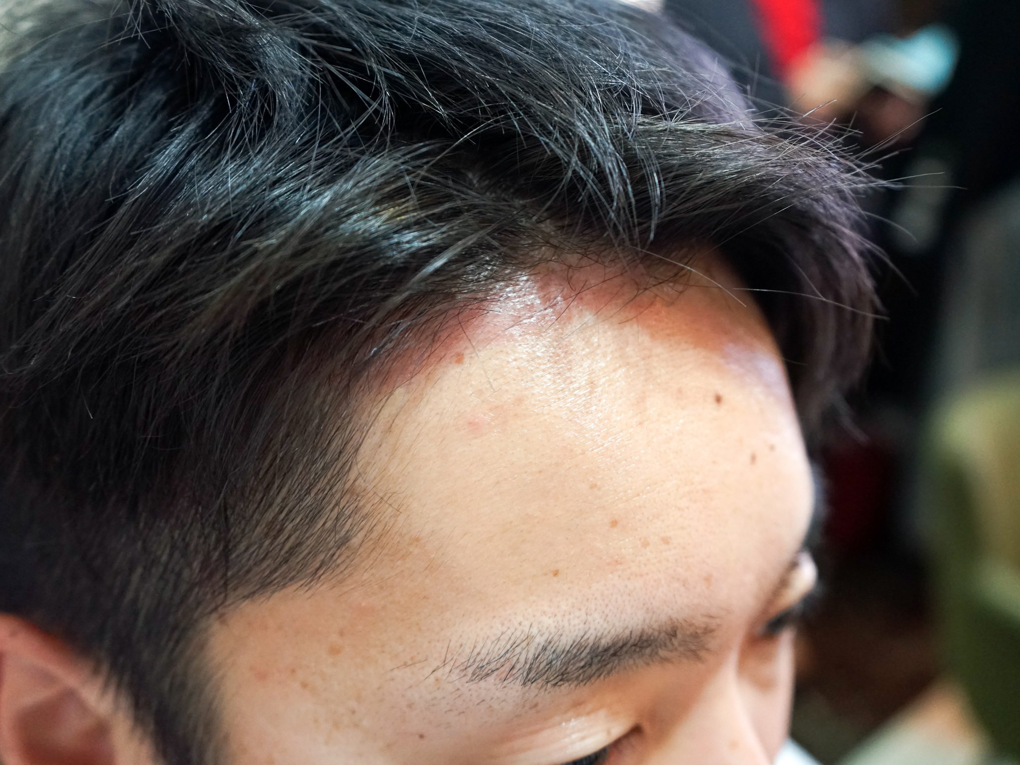 バイオテックの悪い口コミや評判は本当 実際に通って効果検証レビュー Mybest