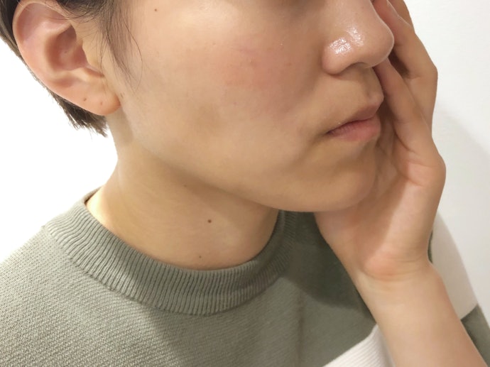 I M Pinch アイムピンチ の悪い口コミや評判を実際に使って検証レビュー Mybest