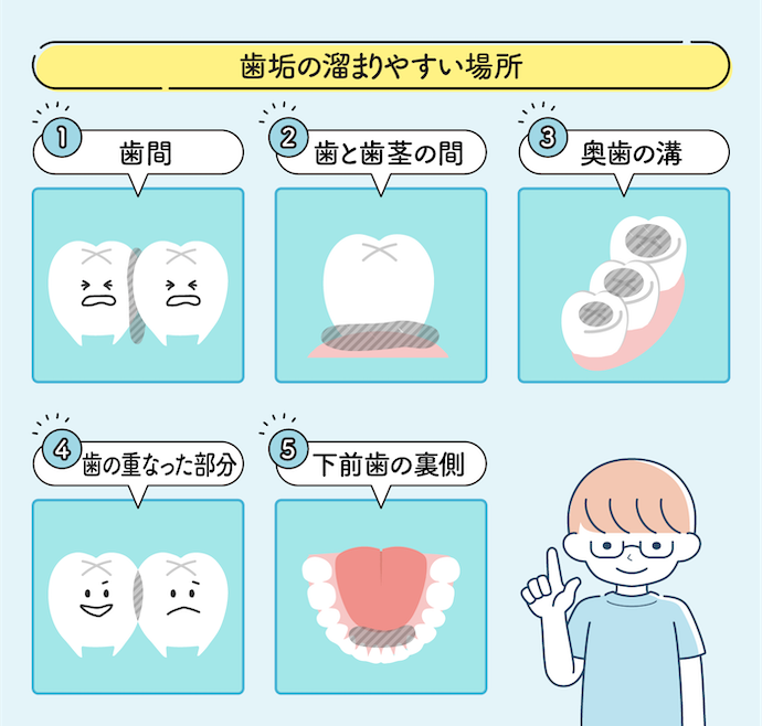 EPEIOS 音波電動歯ブラシ ET003の使い方・磨き方のコツは?