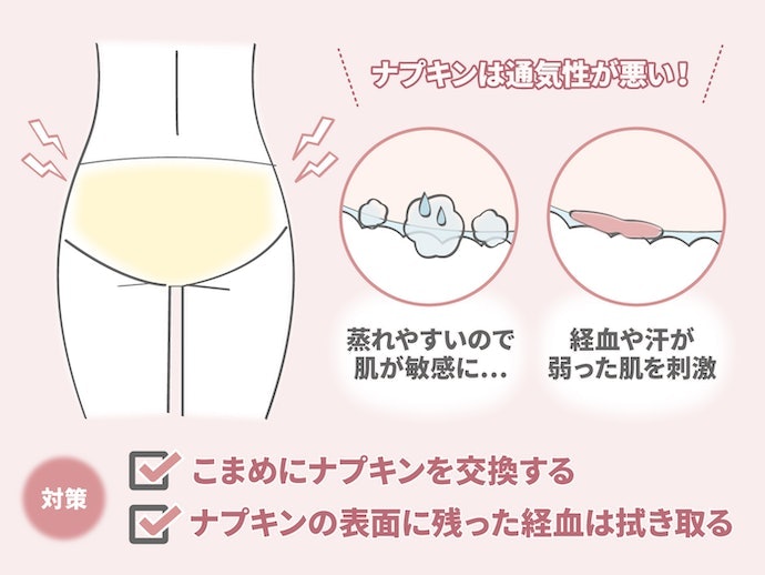 生理中は蒸れやすい!こまめなナプキン交換がおすすめ