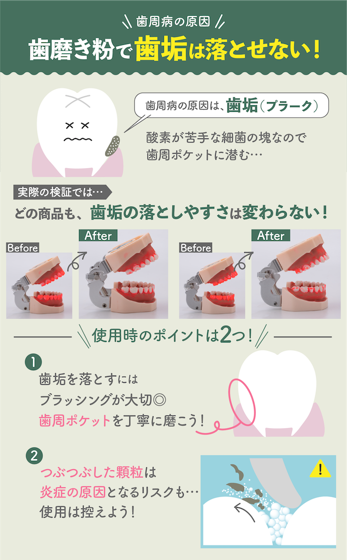 歯周病の原因とは?歯磨き粉で落とせる?