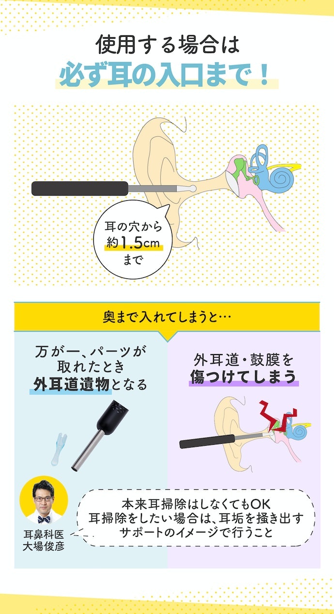 イヤースコープの正しい使い方は?