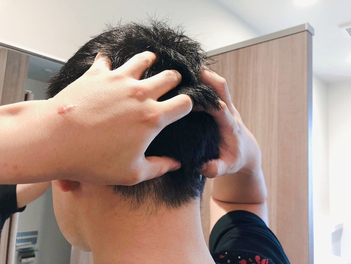 チャップアップ育毛剤の悪い口コミや評判を実際に使って検証レビュー