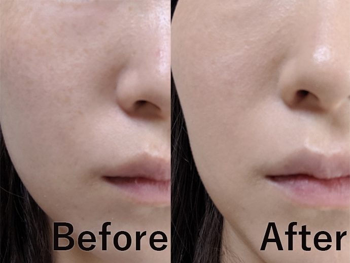 ミシャ M ハーバルパッチクリームを他商品と比較 口コミや評判を実際に使ってレビューしました Mybest