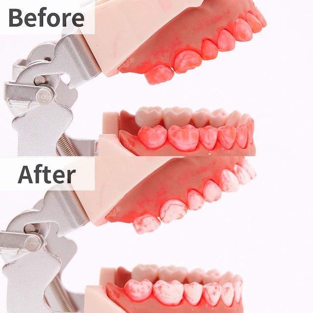 フィリップス ソニッケアー エキスパートクリーン 7500 HX9692を