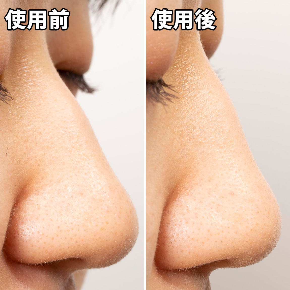 matsukiyo 毛穴パック炭を他商品と比較！口コミや評判を実際に使ってレビューしました！ | mybest