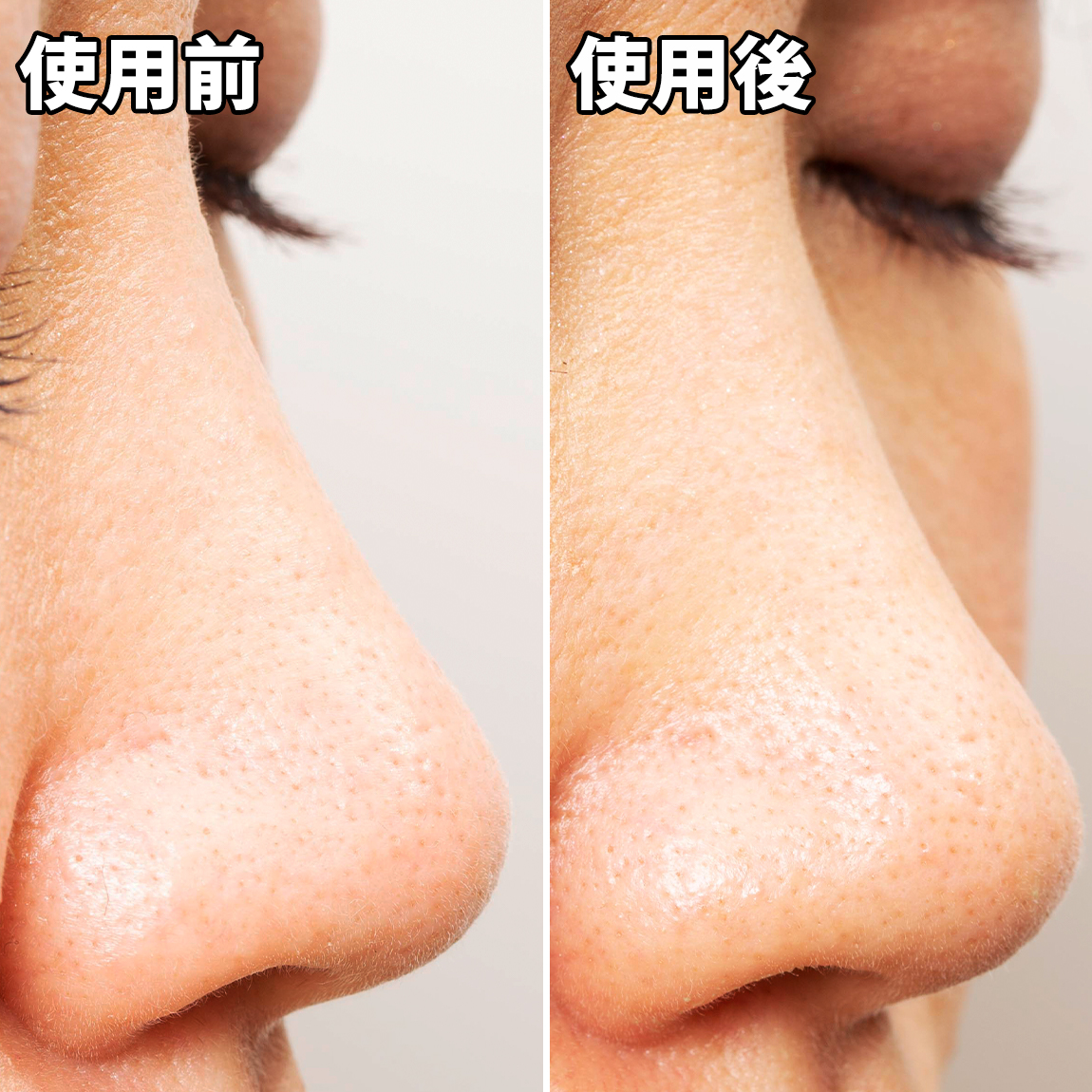 エチュードハウス Grt ノーズシートを他商品と比較 口コミや評判を実際に使ってレビューしました Mybest