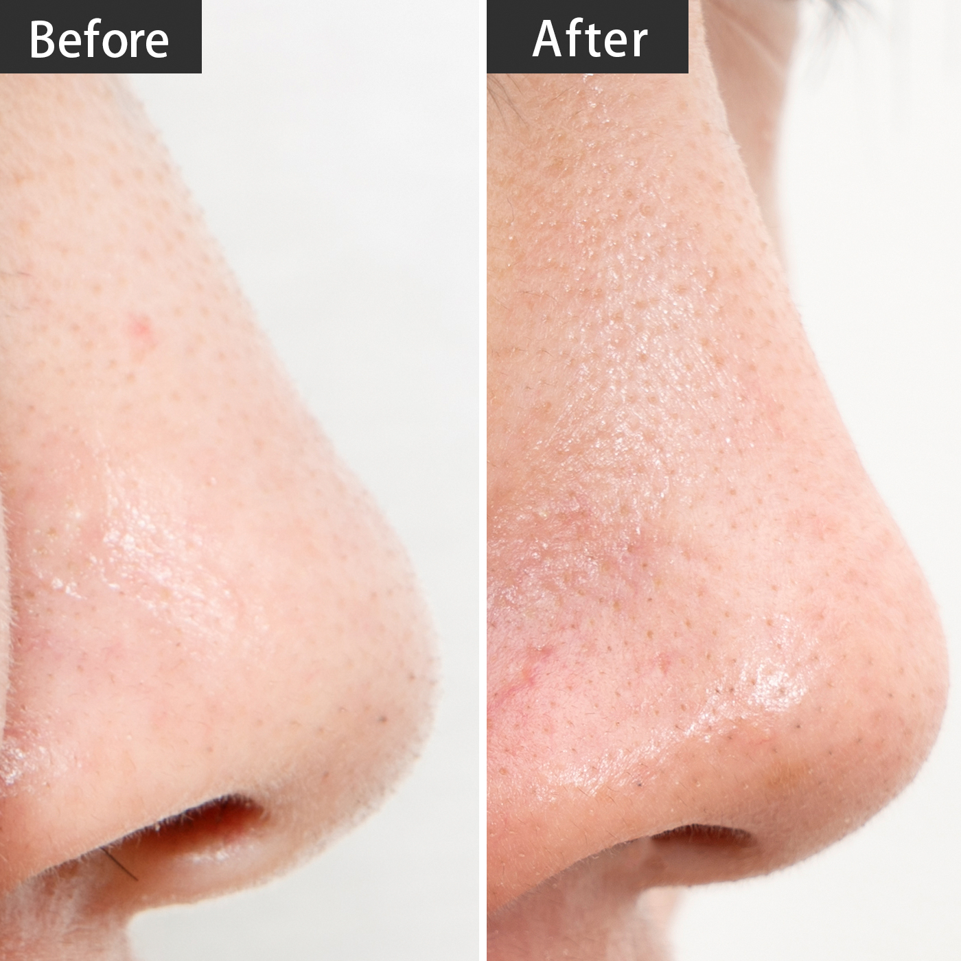 ビーグレン クレイウォッシュを全34商品と比較 口コミや評判を実際に使ってレビューしました Mybest