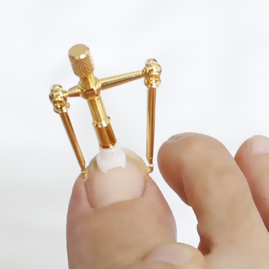 巻き爪ロボの悪い口コミや評判を実際に使って効果検証レビュー Mybest