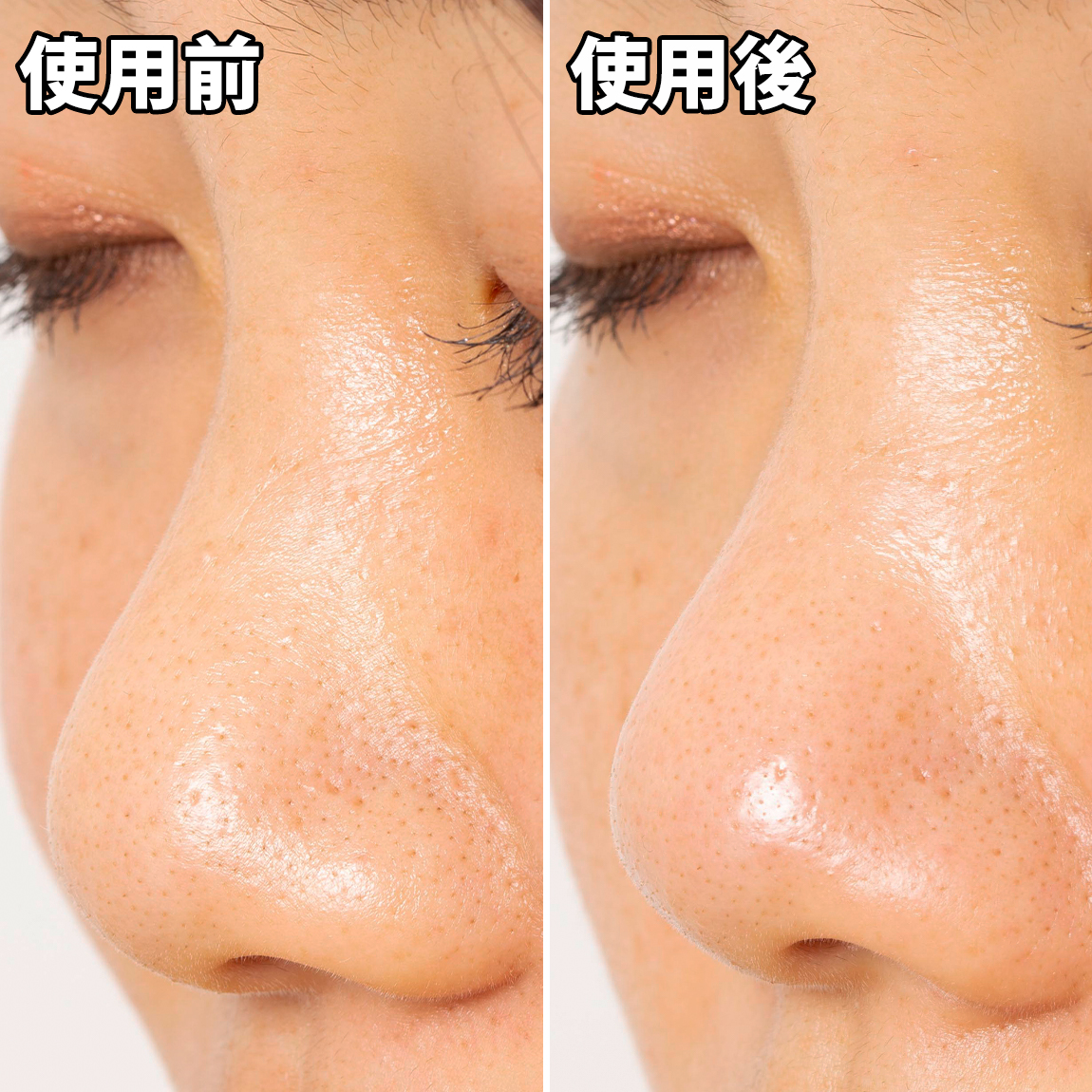 ソフティモ 黒パックを他商品と比較 口コミや評判を実際に使ってレビューしました Mybest