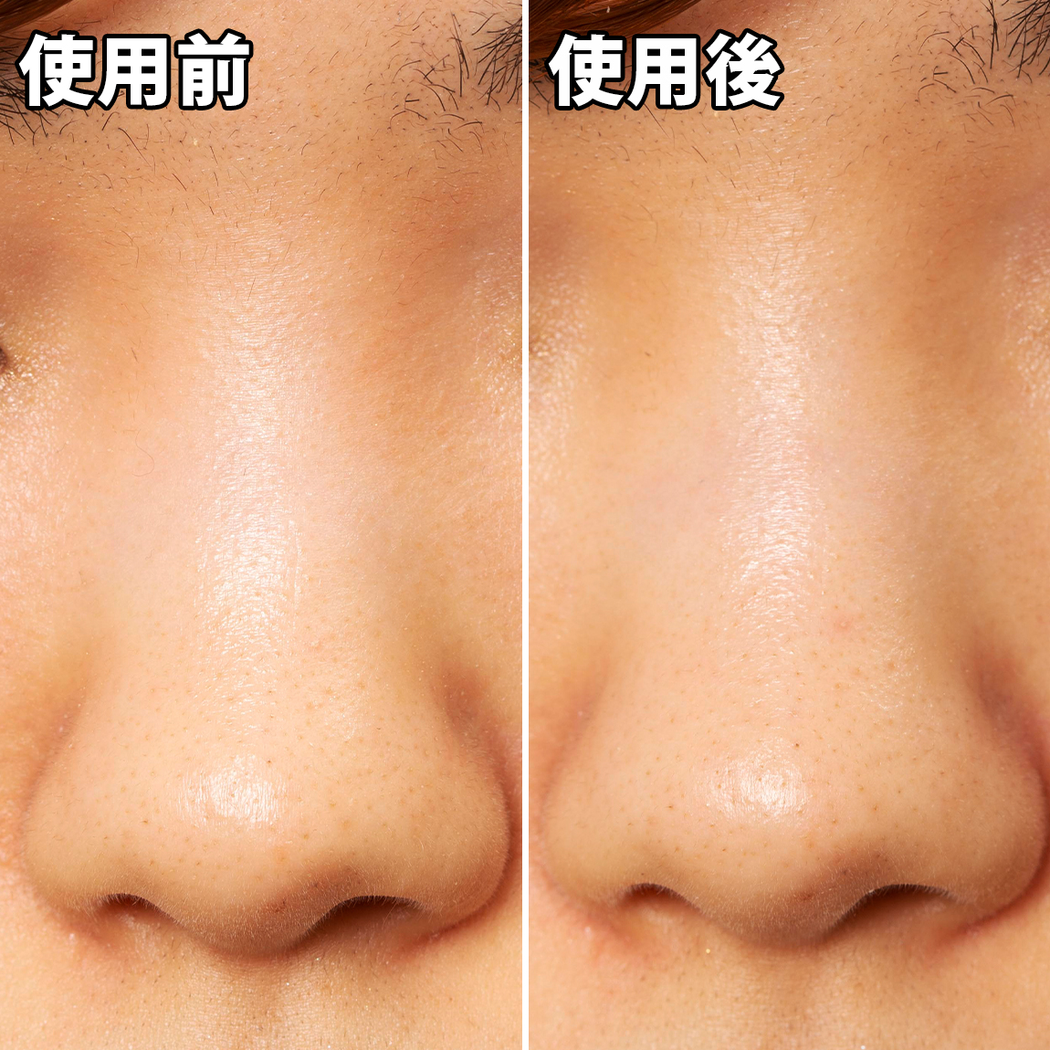 がばいよか剥がすパック 炭黒を他商品と比較 口コミや評判を実際に使ってレビューしました Mybest