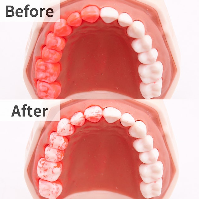 フィリップス ソニッケアー エキスパートクリーン 7500 HX9692を