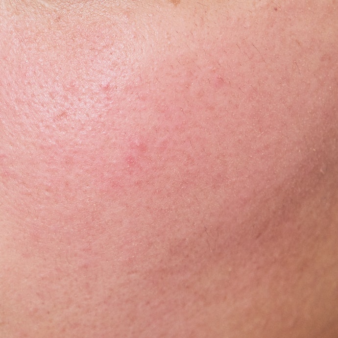 ベリーデリシャス クリームチークを他商品と比較 口コミや評判を実際に使ってレビューしました Mybest