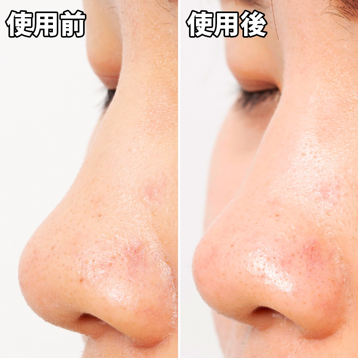 毛穴撫子 小鼻つるりんクリームパックを全12商品と比較！口コミや評判を実際に使ってレビューしました！ | mybest