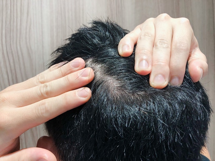 チャップアップ育毛剤の悪い口コミや評判を実際に使って検証レビュー