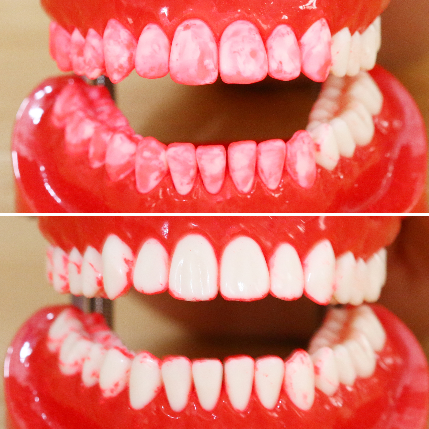 ソニッケアー イージークリーンを全24商品と比較 口コミや評判を実際に使ってレビューしました Mybest