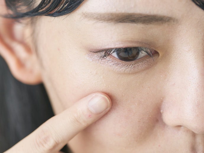 つっぱり感が気になる。すぐに保湿するよう心がけて