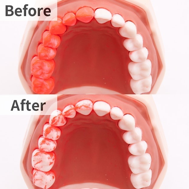 ④歯の裏・奥歯