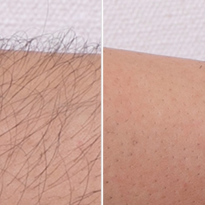 Null メンズ 除毛クリームを他商品と比較 口コミや評判を実際に使ってレビューしました Mybest