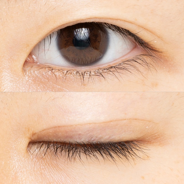 アストレア ヴィルゴ アイビューティーフィクサー WPをレビュー