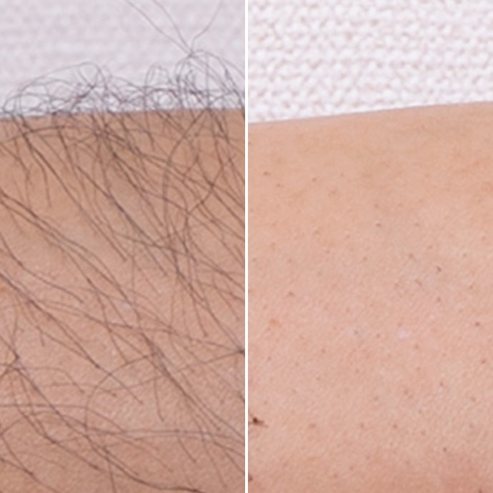 ミュゼコスメ 薬用ヘアリムーバルクリームを他商品と比較 口コミや評判を実際に使ってレビューしました Mybest