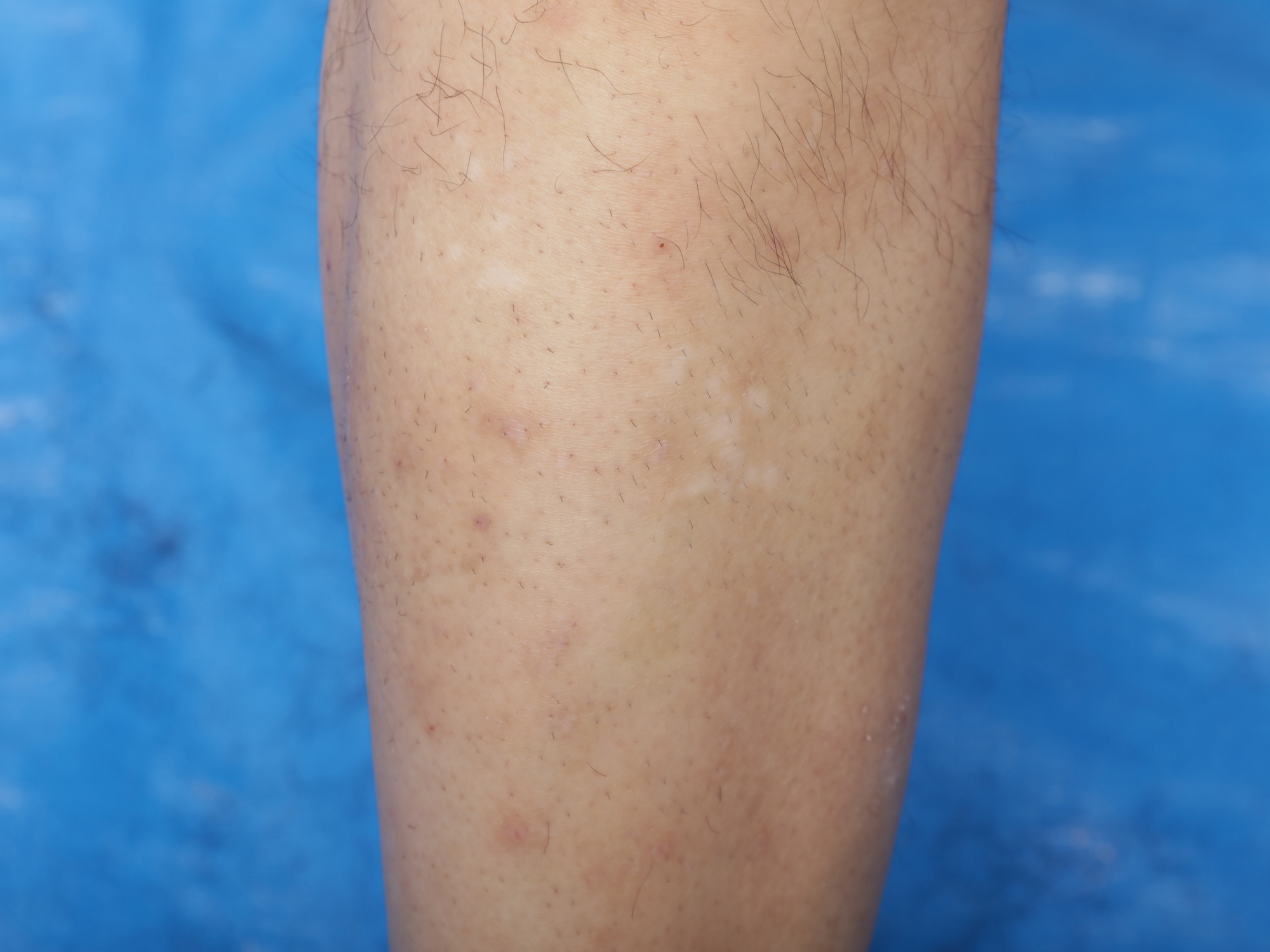 コイズミ レッグヘアトリマーを他商品と比較 口コミや評判を実際に使ってレビューしました Mybest