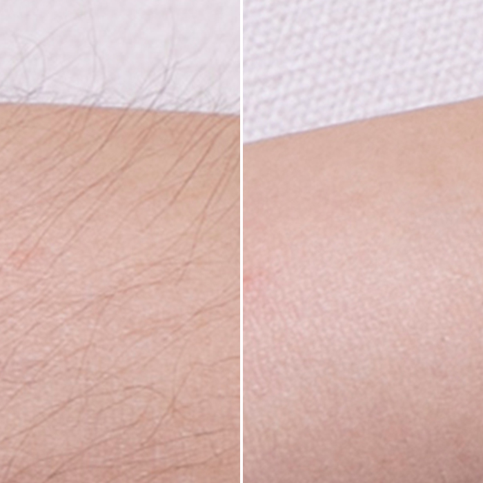 ソランシア リムーバークリームgを全11商品と比較 口コミや評判を実際に使ってレビューしました Mybest