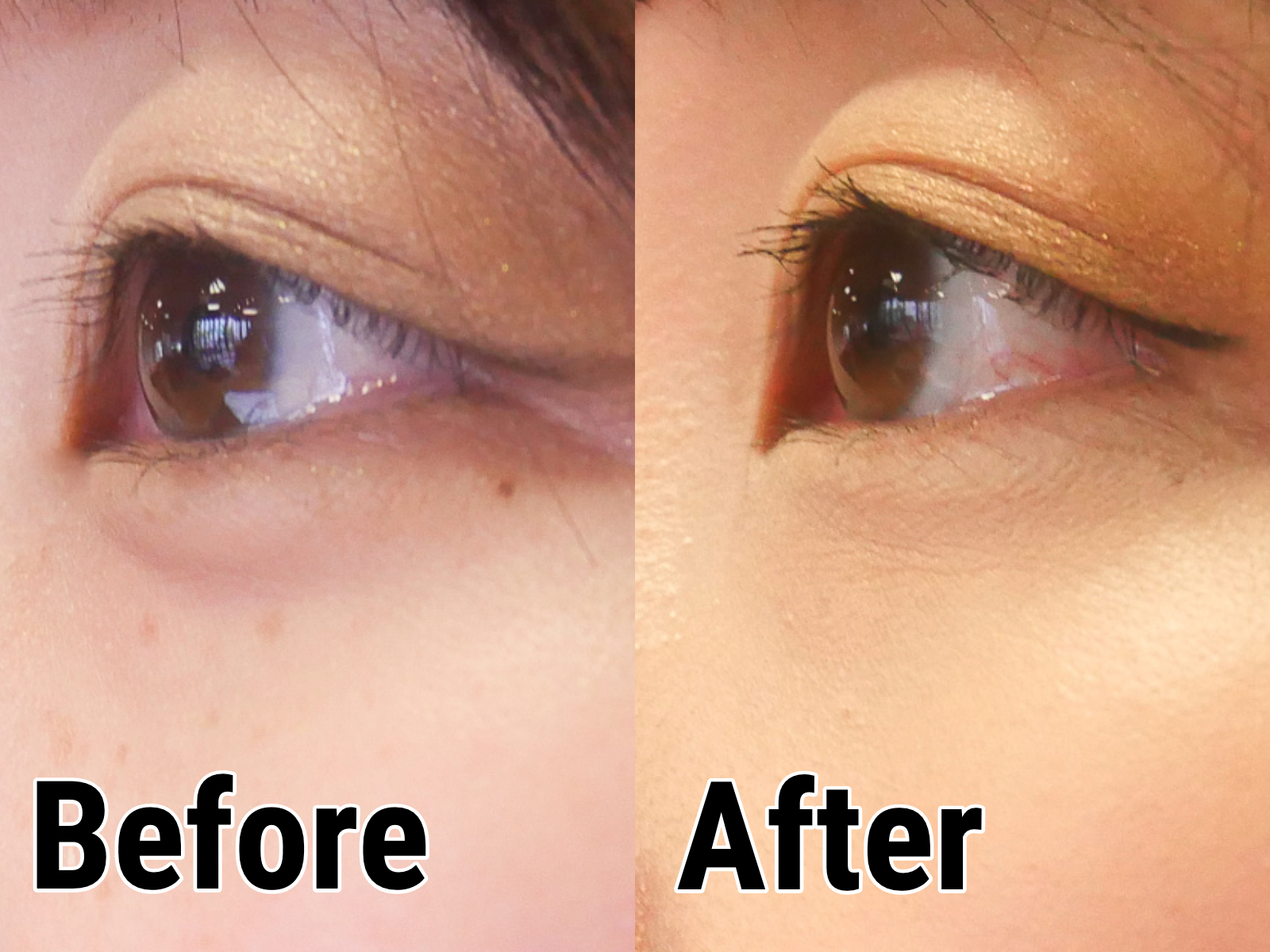 資生堂 スポッツカバー ファウンデイションを他商品と比較 口コミや評判を実際に使ってレビューしました Mybest