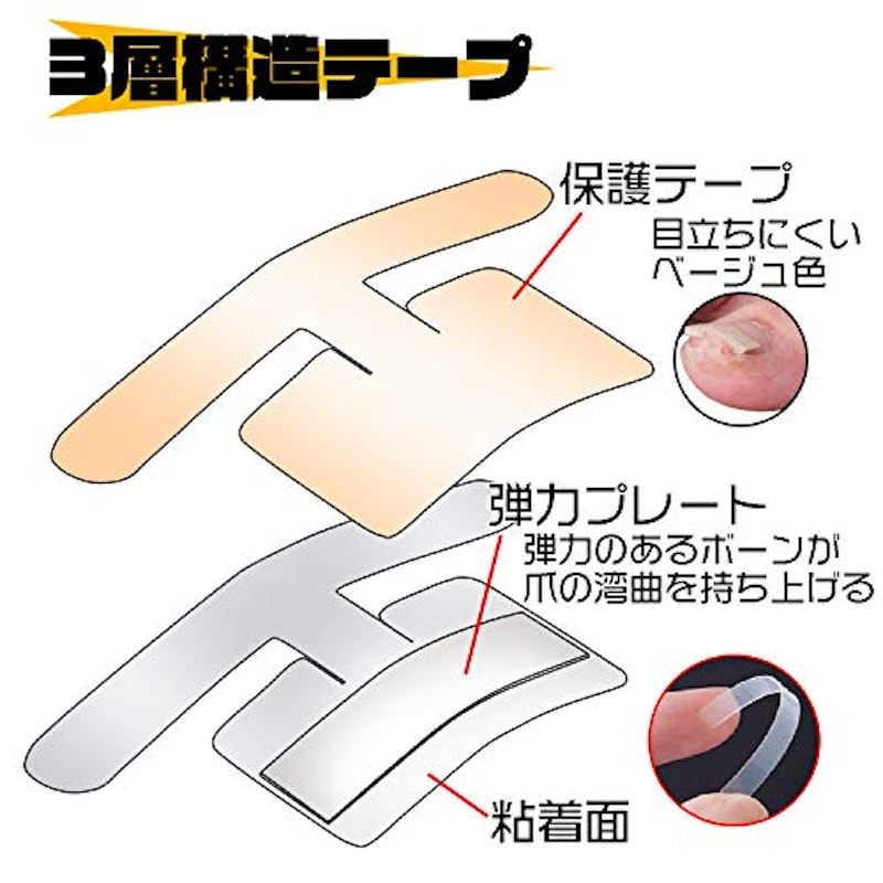 巻き爪ダブルケアテープ 3