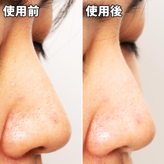 ナリスアップ 毛穴すっきりパックを他商品と比較 口コミや評判を実際に使ってレビューしました Mybest ナリスアップ 毛穴すっきりパックを他商品と比較 口コミや評判を実際に使ってレビューしました Mybest