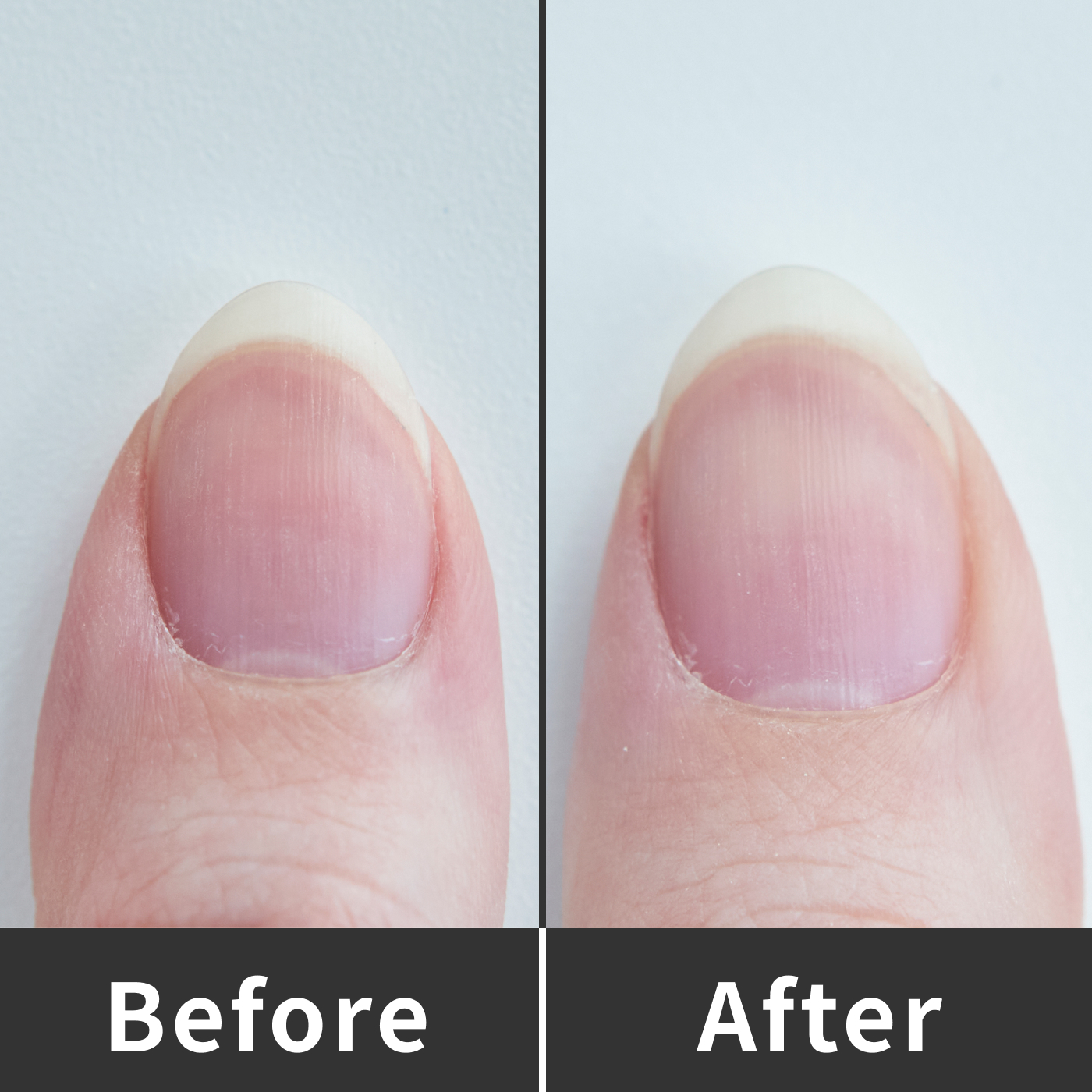 21年 爪磨きのおすすめ人気ランキング18選 徹底比較 Mybest