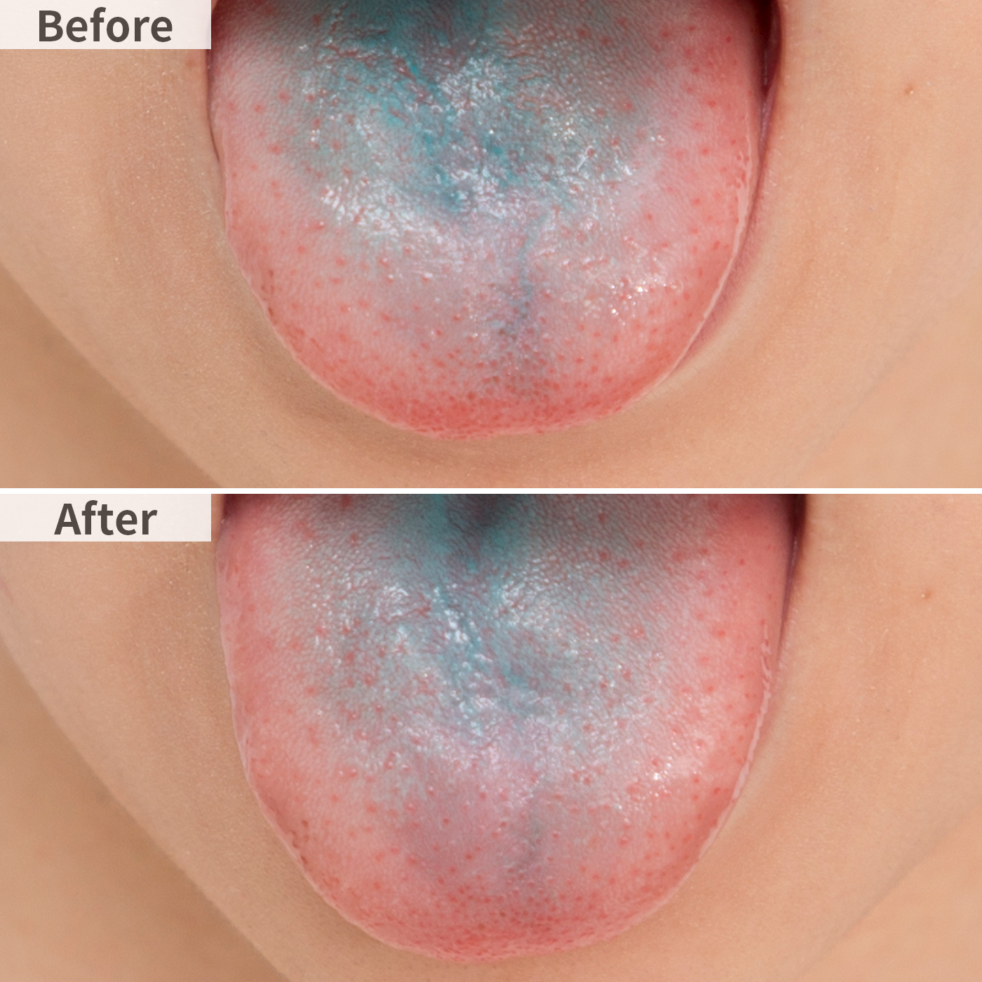 エビス 舌クリーナー ラバーグリップを他商品と比較 口コミや評判を実際に使ってレビューしました Mybest