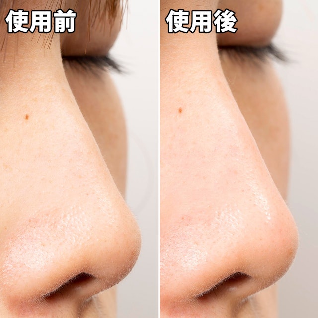 クリアスパー 毛穴パック 炭を他商品と比較 口コミや評判を実際に使ってレビューしました Mybest