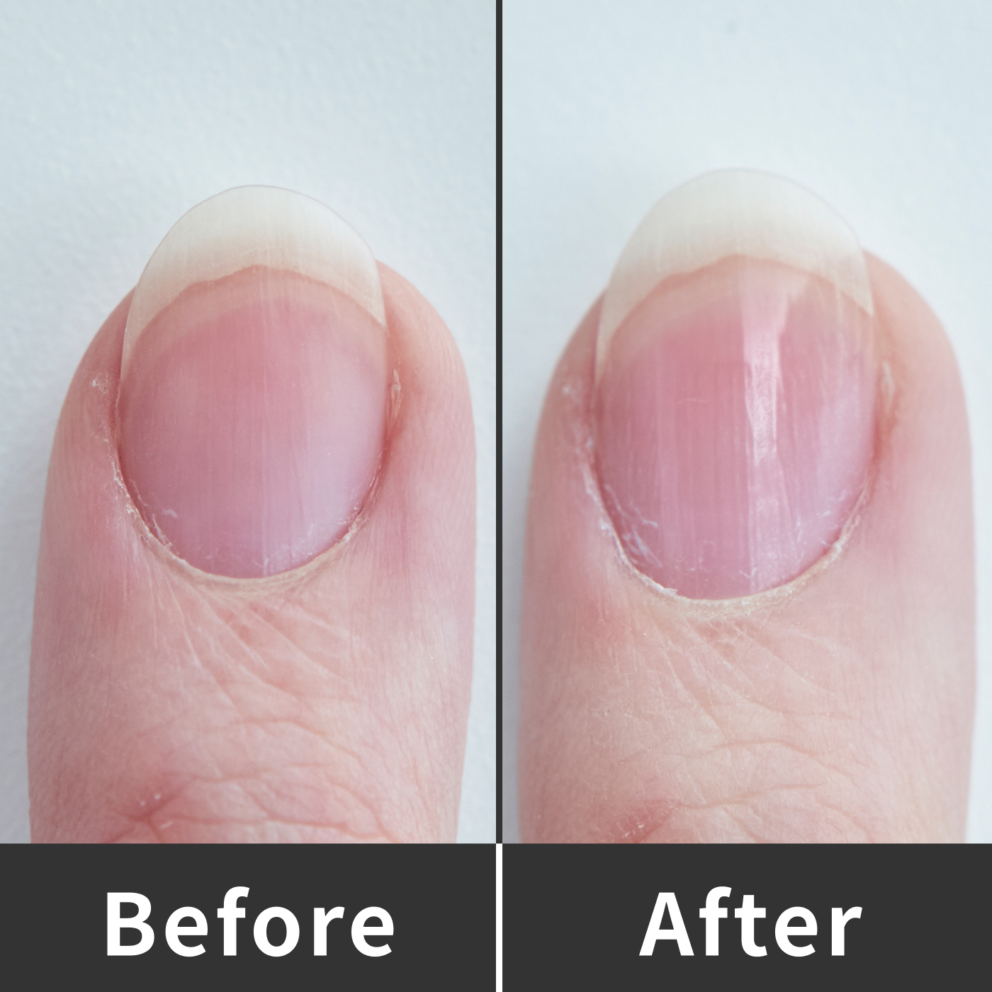 21年 爪磨きのおすすめ人気ランキング18選 徹底比較 Mybest